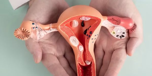 HİSTEROSKOPİ (Rahim içinin gözlenmesi)