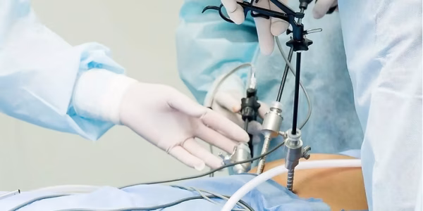 Laparoskopik Histerektomi! Kadın Hastalıkları ve Doğum